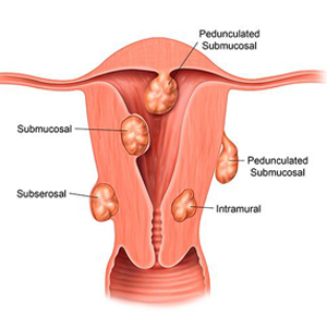 Gallbladder